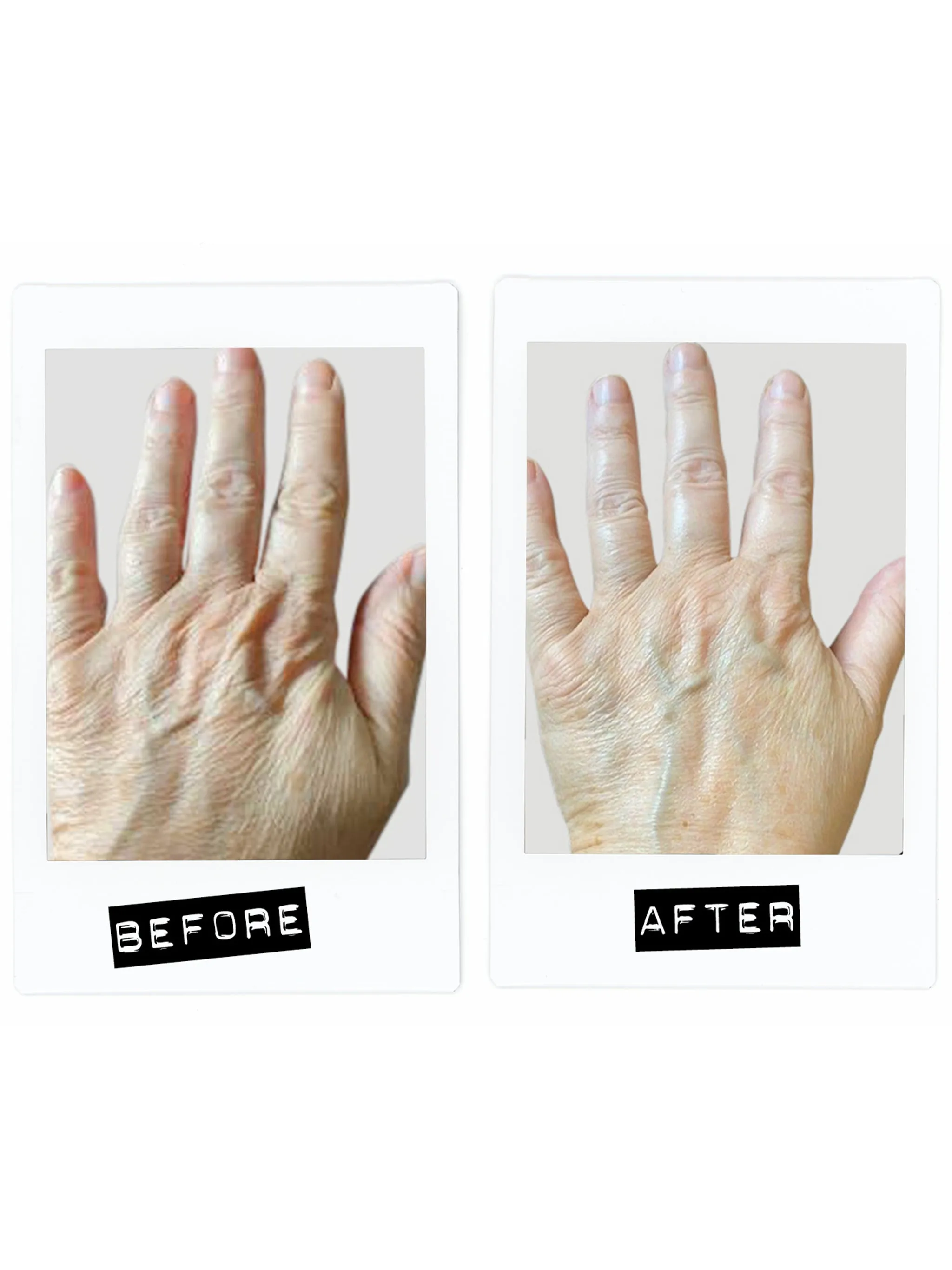 Activating Hand Serum