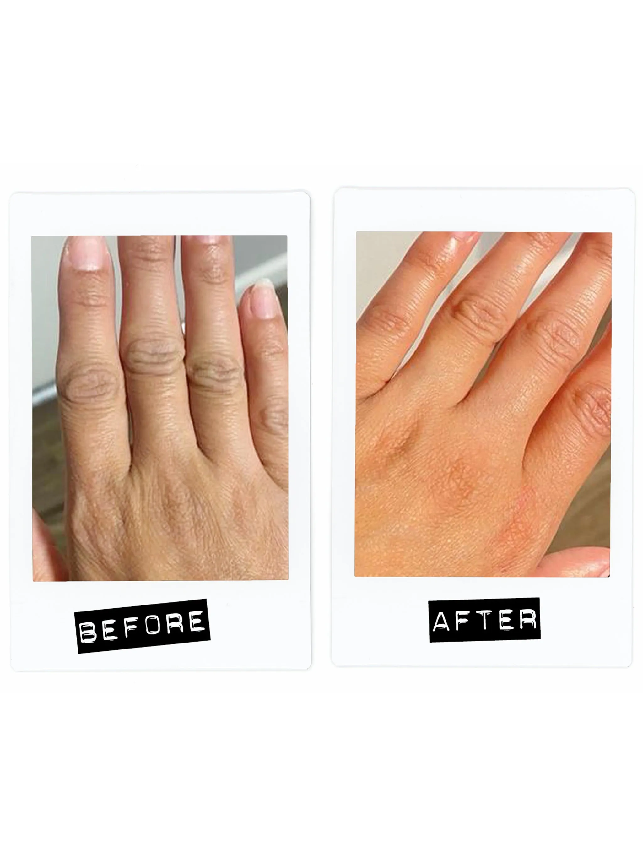 Activating Hand Serum